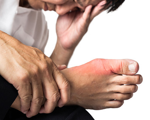 How to Prevent Neuropathy
